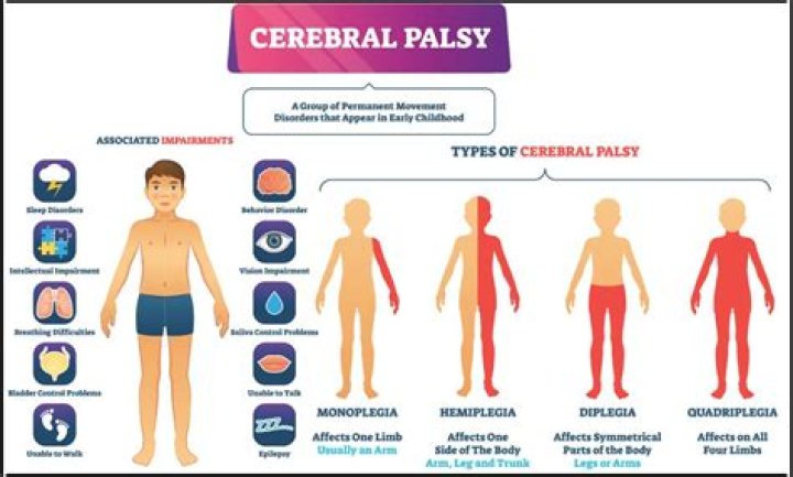 Has cerebral palsy decreased?