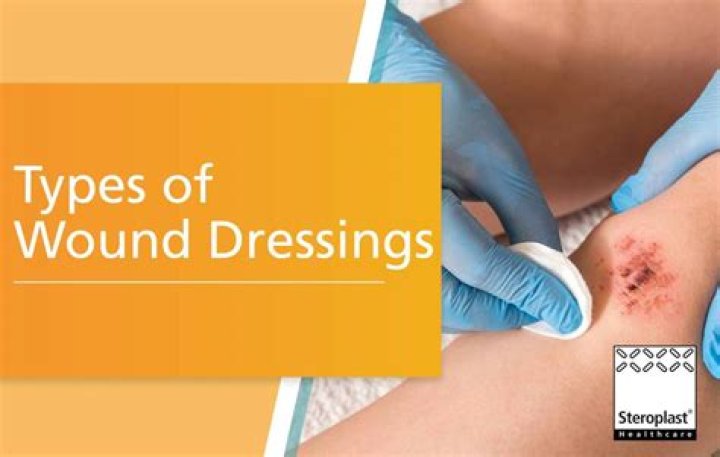 How often should burn dressings be changed?