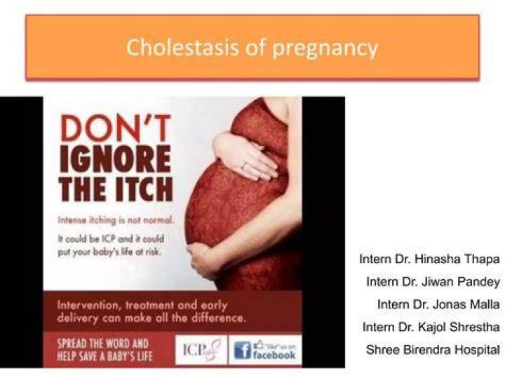 When does obstetric cholestasis start?
