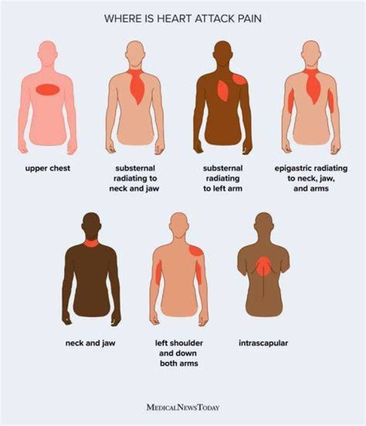 Which arm is painful before a heart attack?
